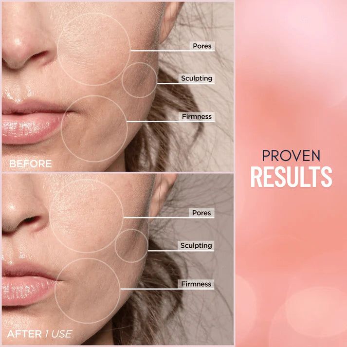 Dolphin™ 7-in-1 LED Facial Sculptor