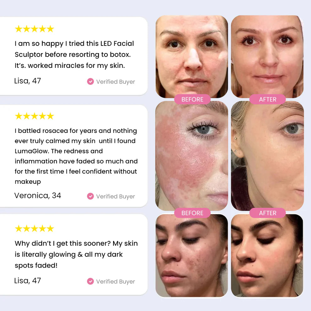 Dolphin™ 7-in-1 LED Facial Sculptor